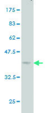 Monoclonal Anti-ACVRL1 antibody produced in