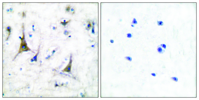 Anti-PGP9.5 antibody produced in rabbit