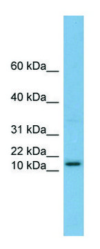 Anti-HRK (N-terminal) antibody produced in