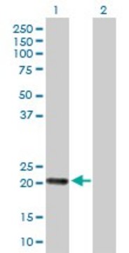 Anti-RGS5 antibody produced in rabbit