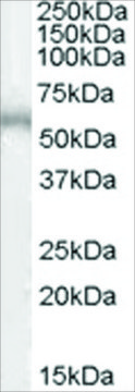 Anti-ADRB1 antibody produced in goat