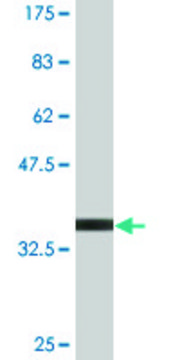 Monoclonal Anti-S100A11 antibody produced in