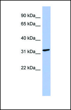 Anti-MAGEB2, (N-terminal) antibody produced in