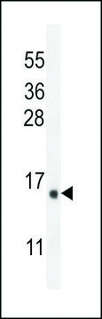 ANTI-IER3(N-TERMINAL) antibody produced in rabbit
