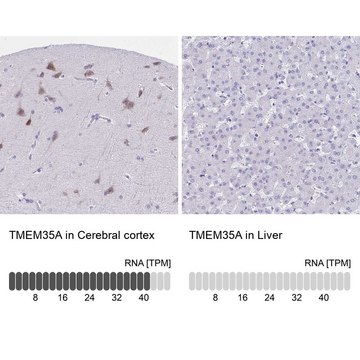 Anti-TMEM35A antibody produced in rabbit