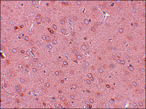 Anti-GOLPH2 antibody produced in rabbit