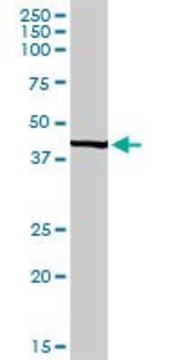 Anti-UBE2Q2 antibody produced in rabbit
