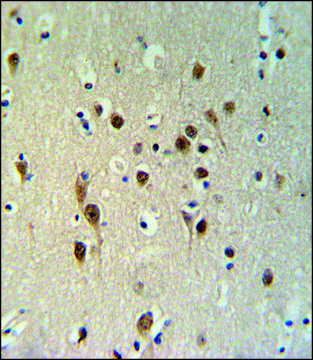 ANTI-TOX3 (CENTER) antibody produced in