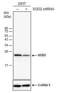 Monoclonal Anti-SOD2 antibody produced in
