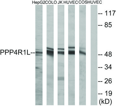 Anti-PPP4R1L antibody produced in rabbit