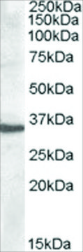 Anti-Apolipoprotein F antibody produced in