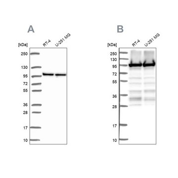 Anti-EEF2 antibody produced in rabbit