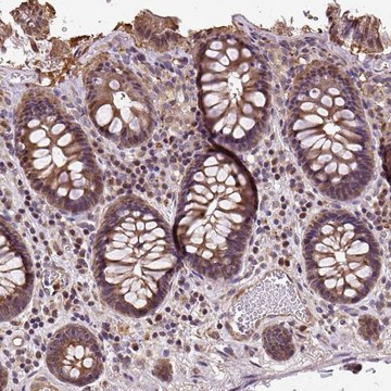 Anti-PUS7L antibody produced in rabbit