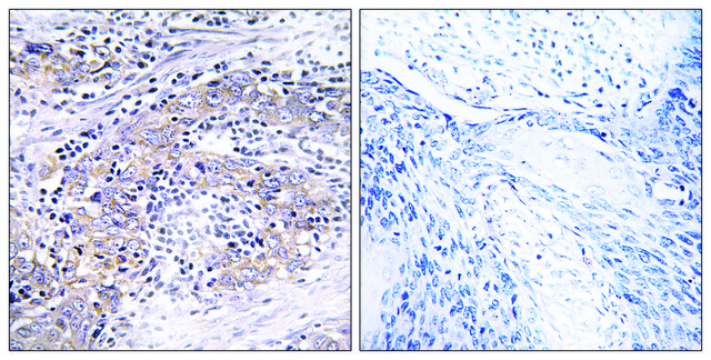 Anti-CLN6 antibody produced in rabbit
