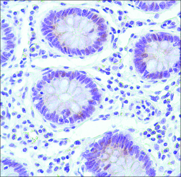 Anti-Cyclin E1 antibody, Rabbit monoclonal