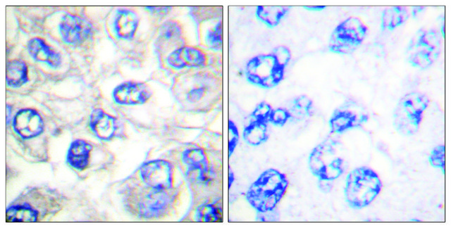 Anti-BAD (Cleaved-Asp?¹) antibody produced in