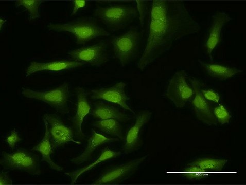 Anti-MAP3K14 antibody produced in rabbit