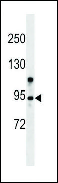 ANTI-ZMYM6(N-TERMINAL) antibody produced in rabbit