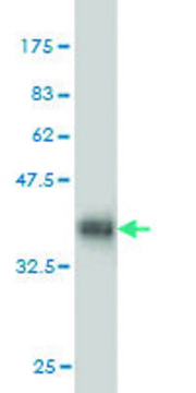 ANTI-ULK2 antibody produced in mouse