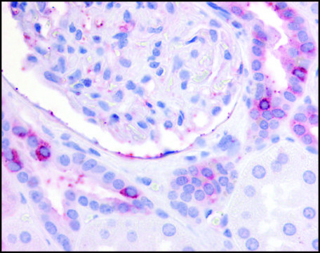 Anti-PTGER2 (AB4) antibody produced in