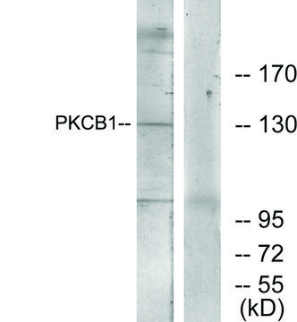 Anti-PKCB1 antibody produced in rabbit
