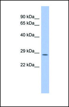 Anti-PSMB10 antibody produced in rabbit