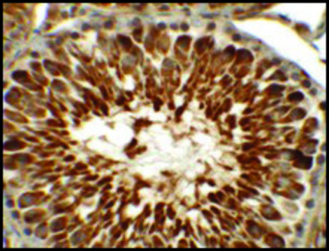 Anti-TEKT5 antibody produced in rabbit