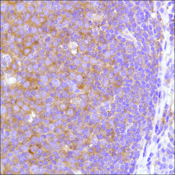 Anti-VPAC2 antibody, Rabbit monoclonal