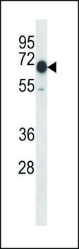 ANTI-MOUSE CAMKK2 (N-TERM) antibody produced