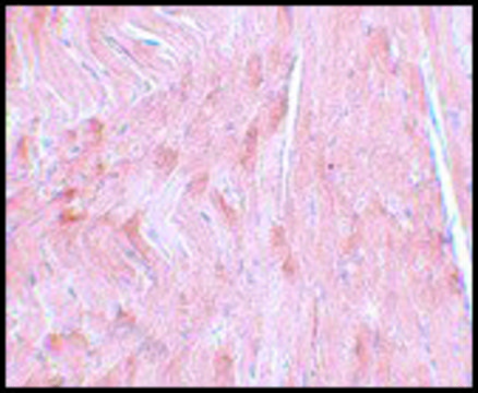 Anti-REEP3 antibody produced in rabbit