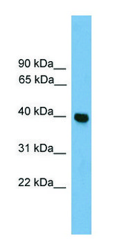 Anti-GNAI3 antibody produced in rabbit
