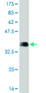 Monoclonal Anti-ARHGEF1, (C-terminal) antibody produced