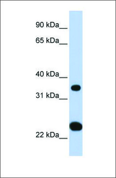Anti-SLC25A35 antibody produced in rabbit