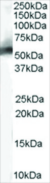 Anti-MDM2 (Isoform) antibody produced in