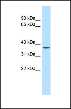 Anti-FOXE3, (N-terminal) antibody produced in