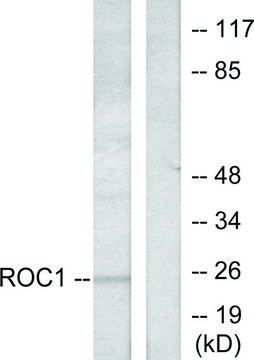 Anti-RIT1 antibody produced in rabbit