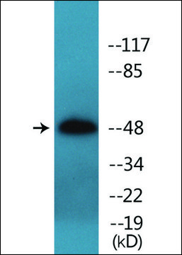 Anti-phospho-IL-13R ?1 (pTyr???) antibody produced