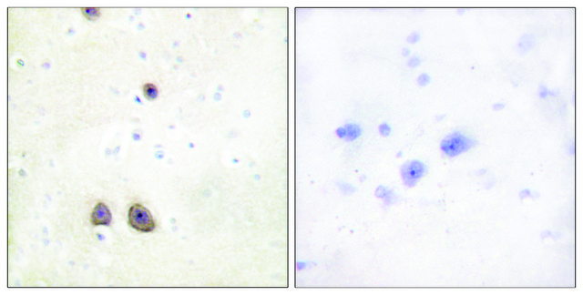 Anti-Caper antibody produced in rabbit