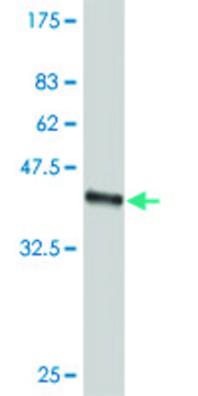 ANTI-SMO antibody produced in mouse
