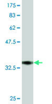 Monoclonal Anti-TRPV5, (N-terminal) antibody produced