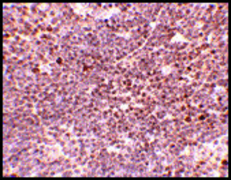 Anti-S1P1 antibody produced in rabbit