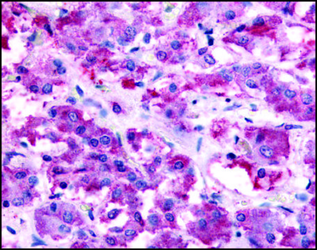 Anti-NMUR2 antibody produced in rabbit