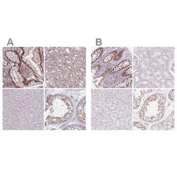 Anti-ZC3H14 antibody produced in rabbit