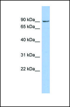 Anti-NPHP1 antibody produced in rabbit