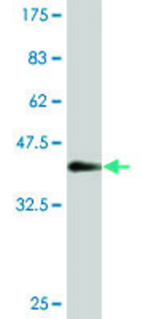 Monoclonal Anti-CNDP2 antibody produced in