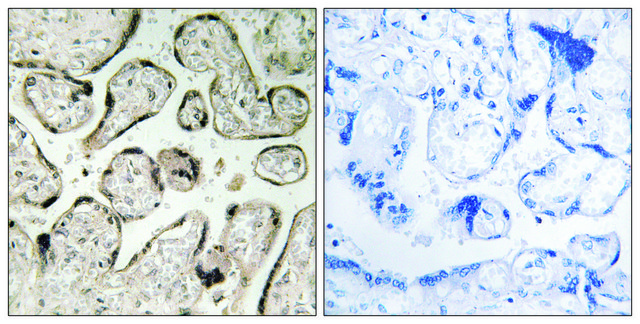 Anti-GIMAP5 antibody produced in rabbit