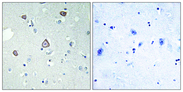 Anti-GRM2 antibody produced in rabbit