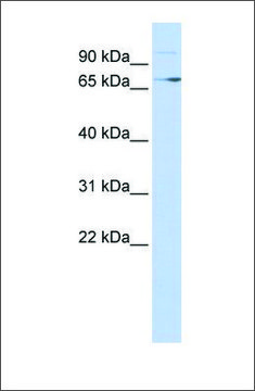 Anti-TP73 antibody produced in rabbit