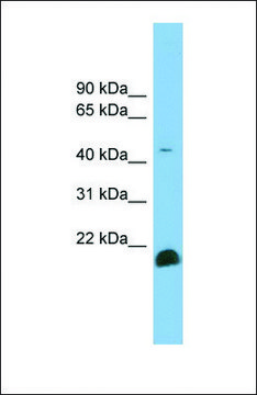 Anti-TGFB2 antibody produced in rabbit