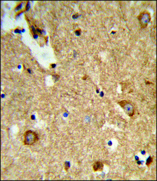 ANTI-ENTPD2 (N-TERM) antibody produced in